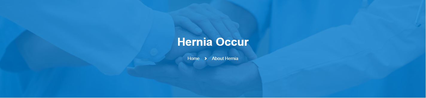 Hernia Occur